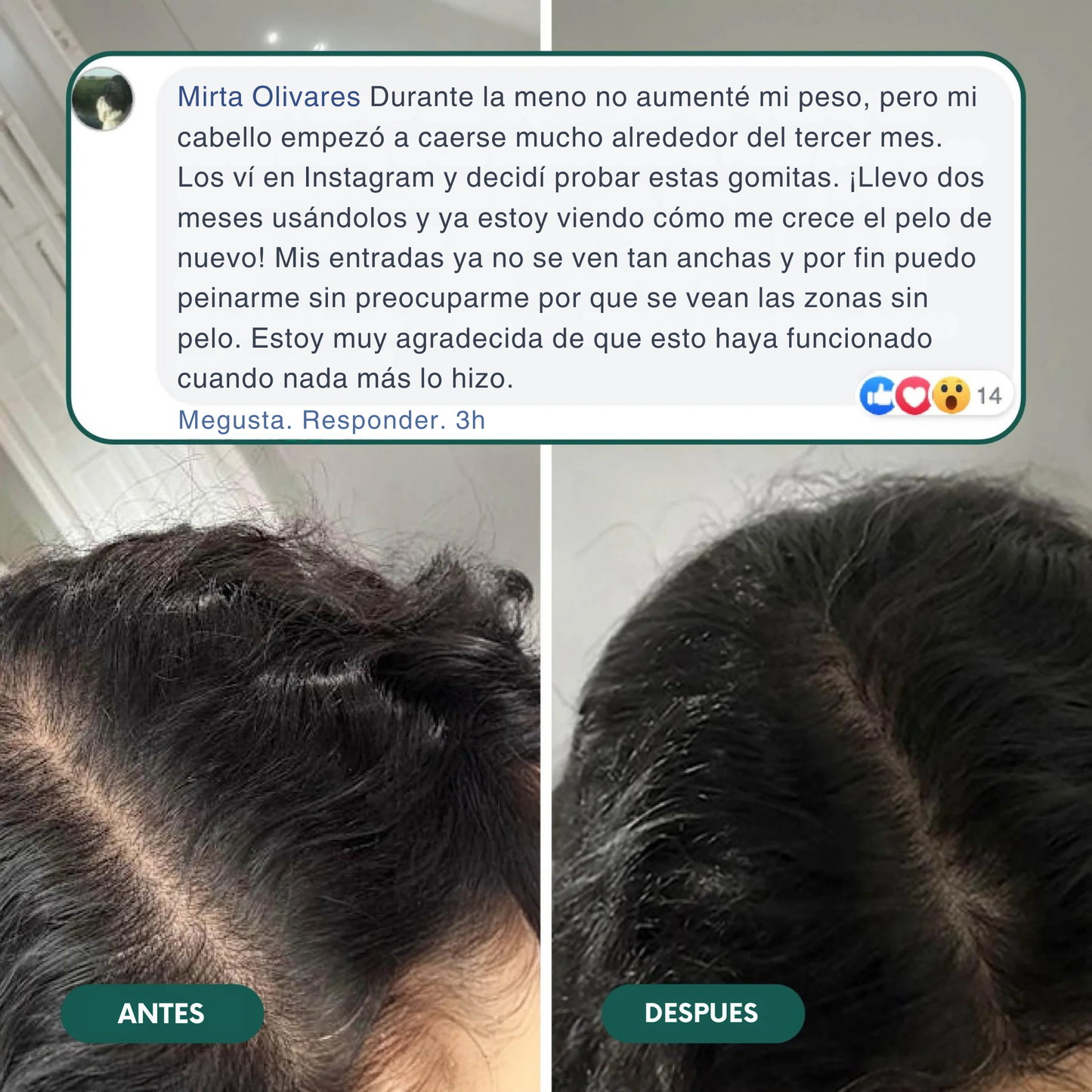 Gomitas revitalizantes para el cabello